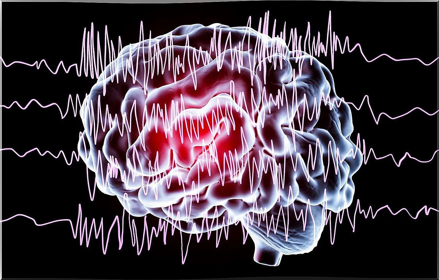 brain suffering from the effects of interrupted sleep